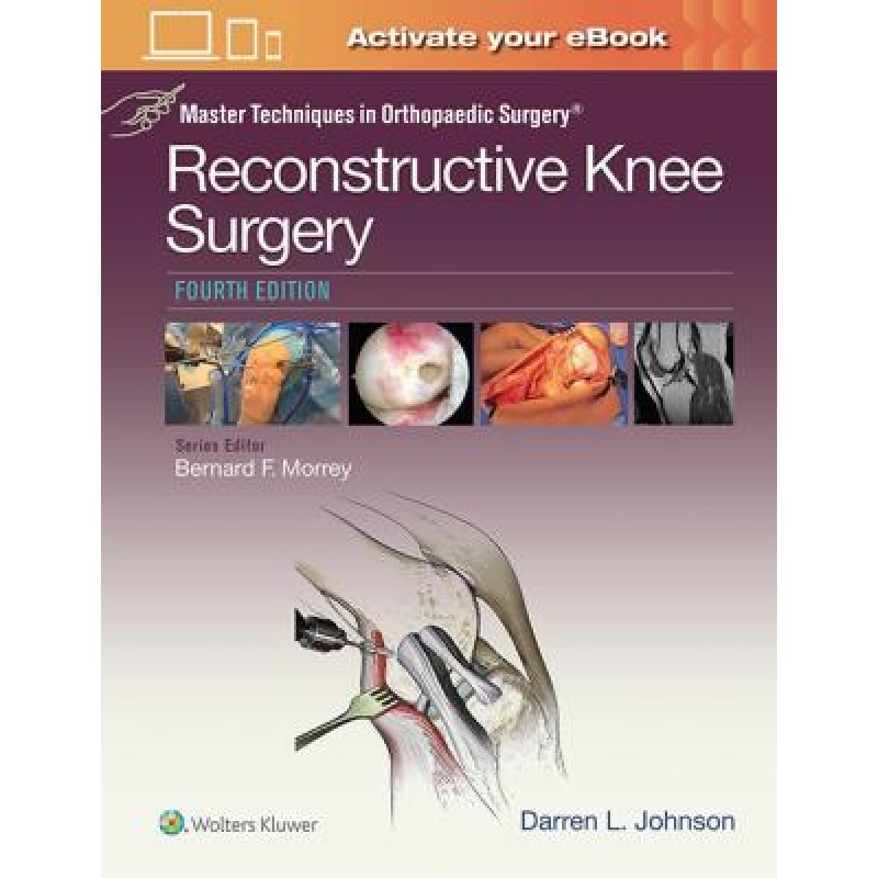 Master Techniques in Orthopaedic Surgery: Reconstructive Knee Surgery, 4e 