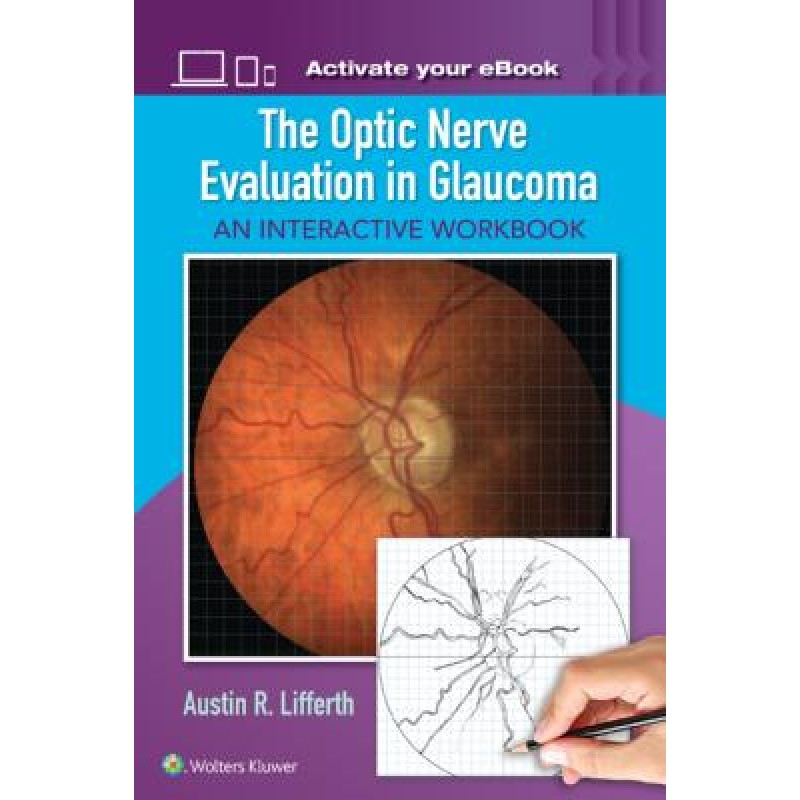 The Optic Nerve Evaluation in Glaucoma AN INTERACTIVE WORKBOOK