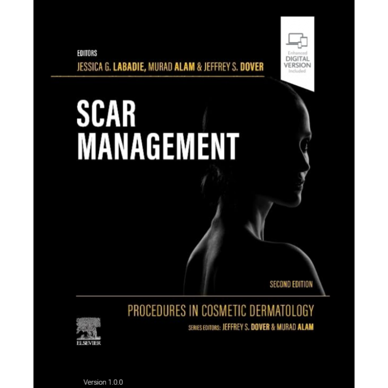 Procedures in Cosmetic Dermatology: Scar Management, 2nd Edition