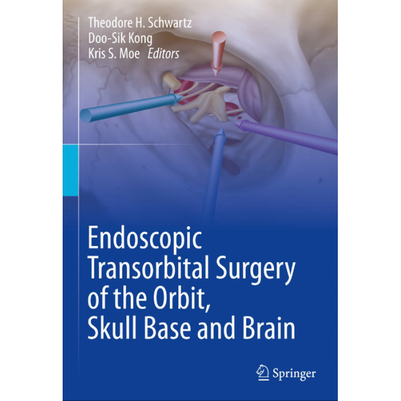 Endoscopic Transorbital Surgery of the Orbit, Skull Base and Brain