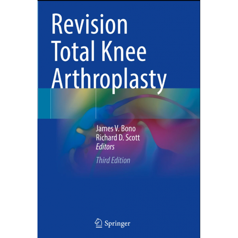 Revision Total Knee Arthroplasty