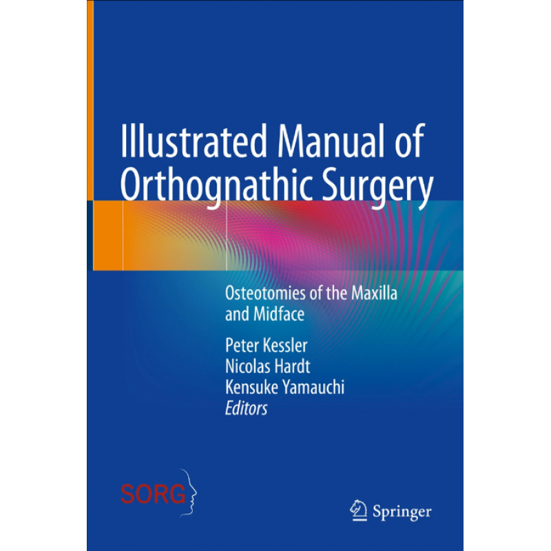 Illustrated Manual of Orthognathic Surgery. Osteotomies of the Maxilla and Midface