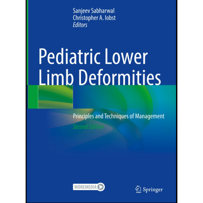 Pediatric Lower Limb Deformities. Principles and Techniques of Management