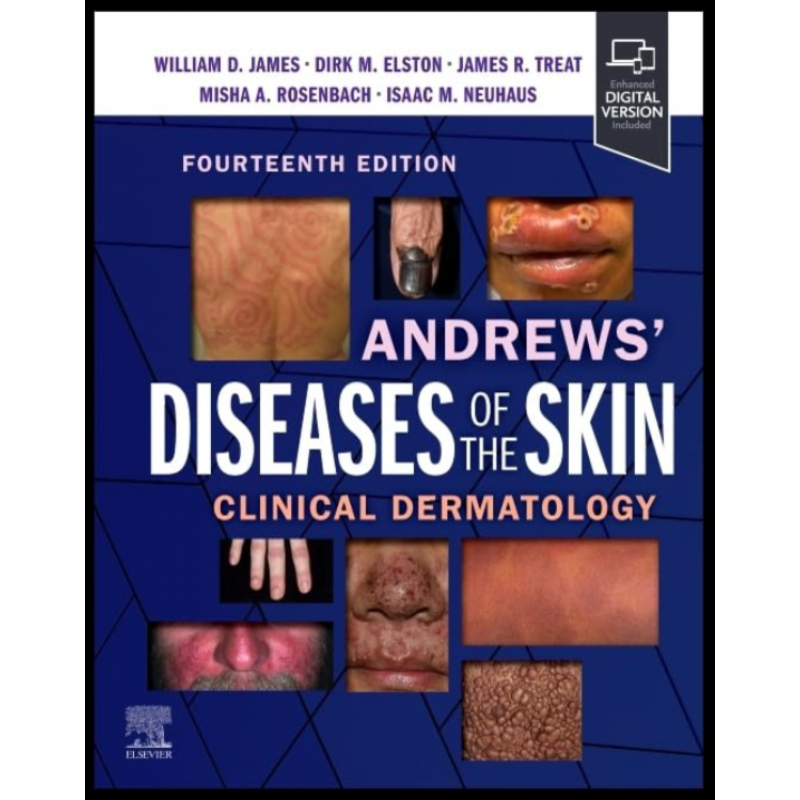 Andrews’ Diseases of the Skin, 14th Edition. Clinical Dermatology