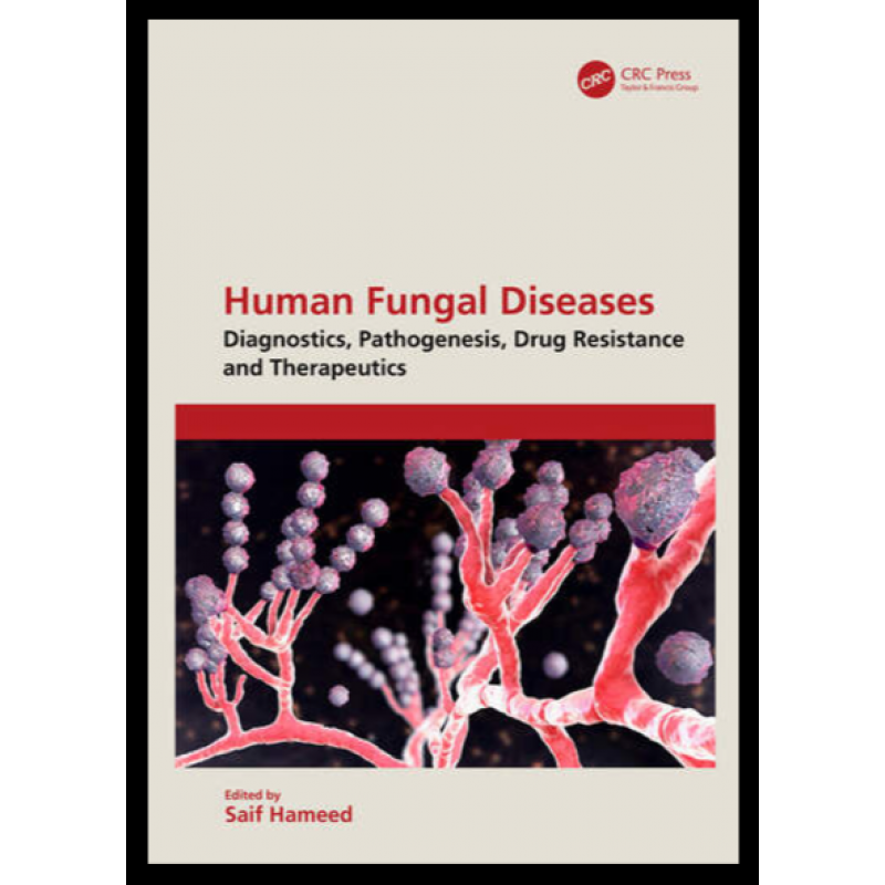 Human Fungal Diseases. Diagnostics, Pathogenesis, Drug Resistance and Therapeutics