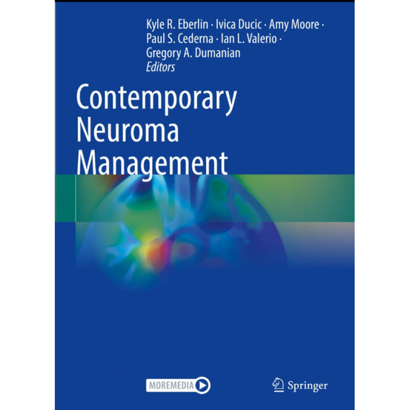 Contemporary Neuroma Management