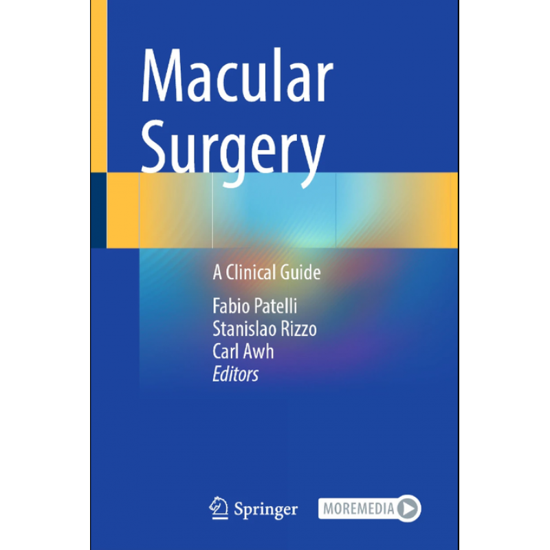 Macular Surgery. A Clinical Guide