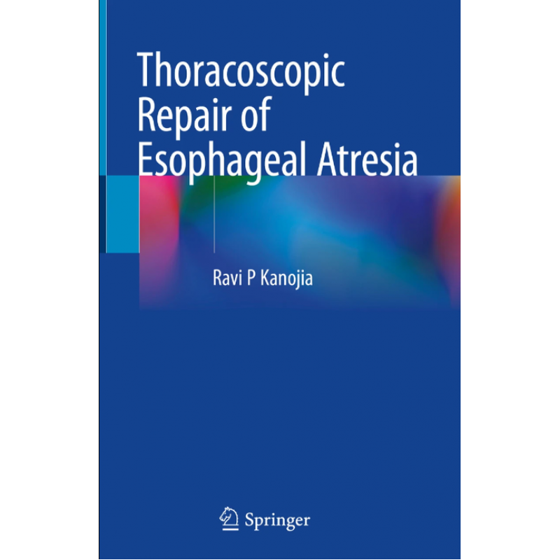 Thoracoscopic Repair of Esophageal Atresia