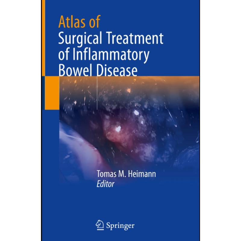 Atlas of Surgical Treatment of Inflammatory Bowel Disease