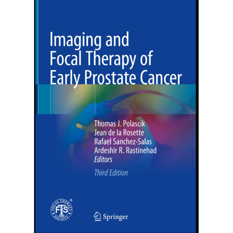 Imaging and Focal Therapy of Early Prostate Cancer