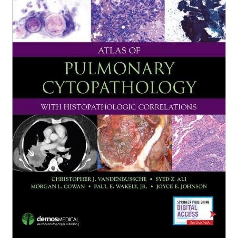 Atlas of Pulmonary Cytopathology With Histopathologic Correlations