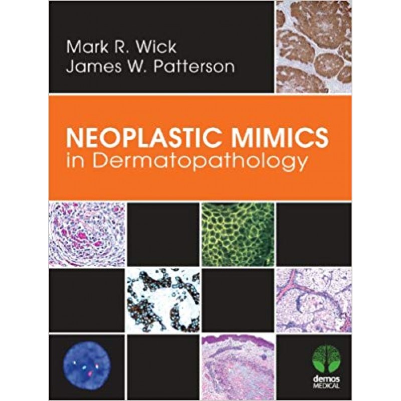 Neoplastic Mimics in Dermatopathology