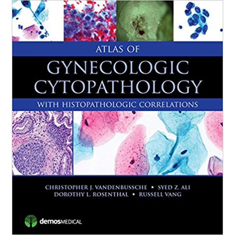 Atlas of Gynecologic Cytopathology With Histopathologic Correlations