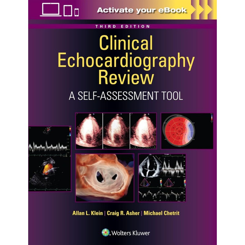 Clinical Echocardiography Review: A Self-Assessment Tool, 3rd Edition