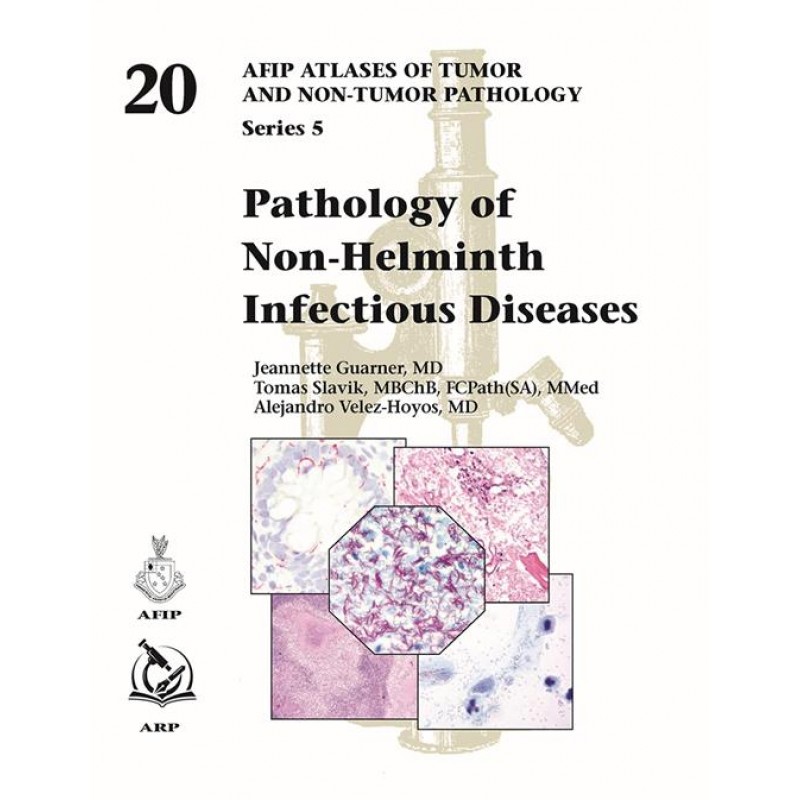 Pathology of Non-Helminth Infectious Diseases