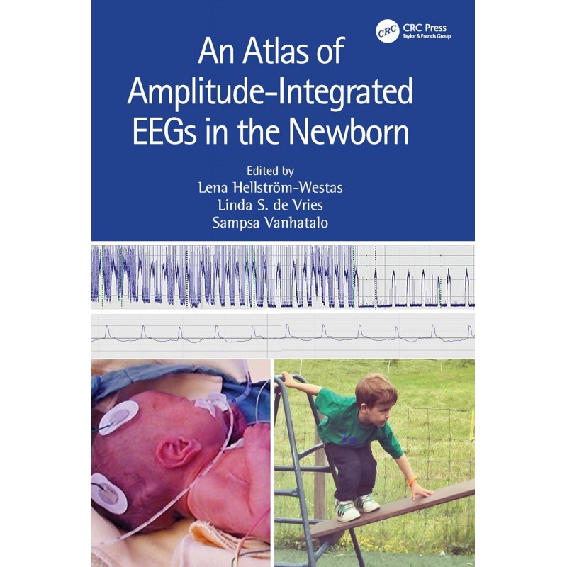 An Atlas of Amplitude-Integrated EEGs in the Newborn 3rd Edition