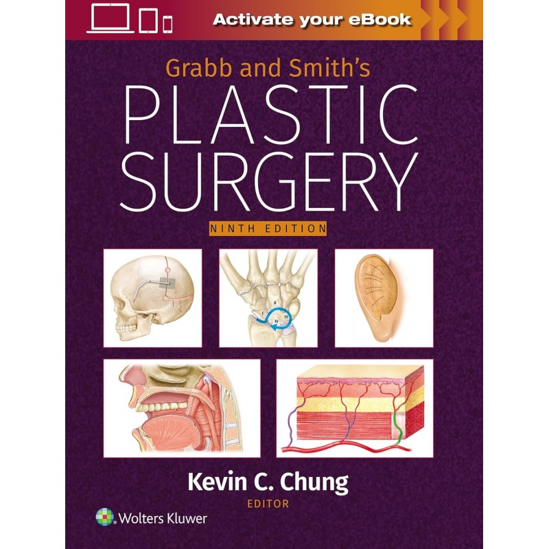  Grabb and Smith's Plastic Surgery: Print + eBook