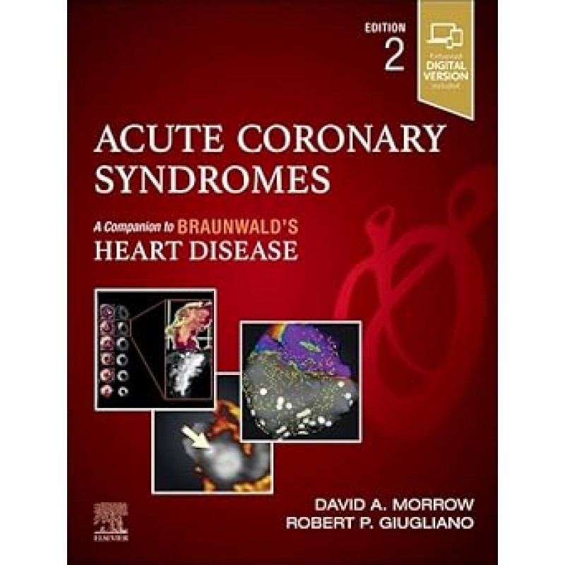 Acute Coronary Syndromes, 2nd Edition