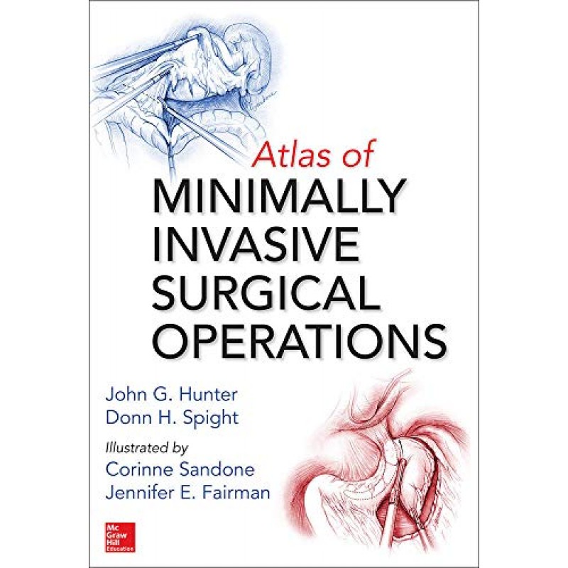 Atlas of Minimally Invasive Surgical Operations by Hunter