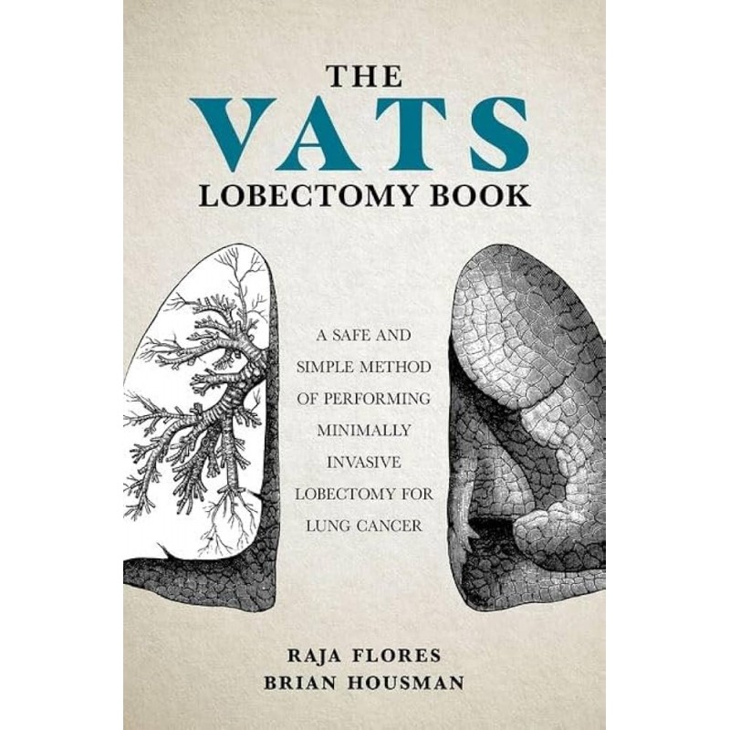 The VATS Lobectomy Book. A Safe and Simple Method of Performing Minimally Invasive Lobectomy for Lung Cancer