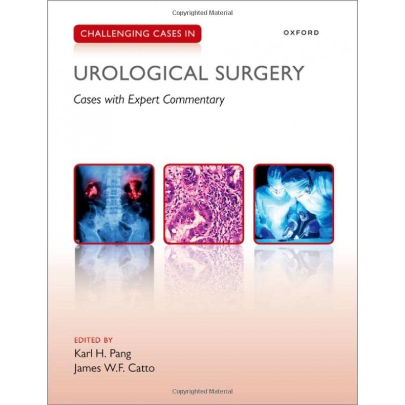 Challenging Cases in Urological Surgery (Cases with Expert Commentary)