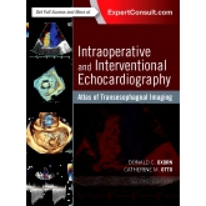 Intraoperative and Interventional Echocardiography, 2nd Edition