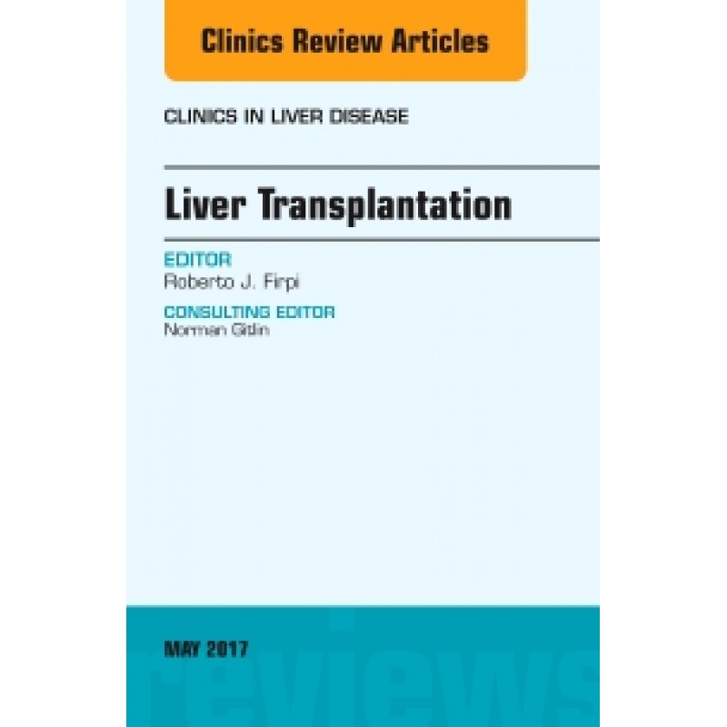 Liver Transplantation, An Issue of Clinics in Liver Disease, Volume 21-2