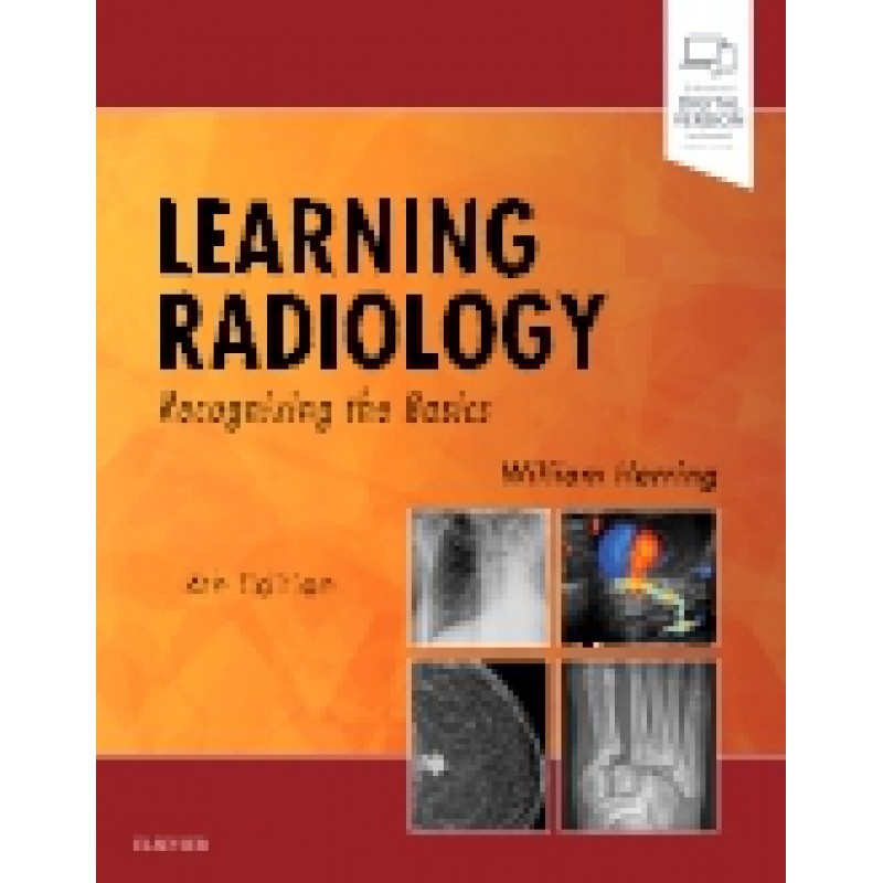 Learning Radiology, 4th Edition