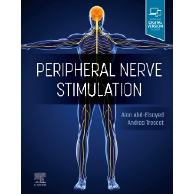 Peripheral Nerve Stimulation: A Comprehensive Guide