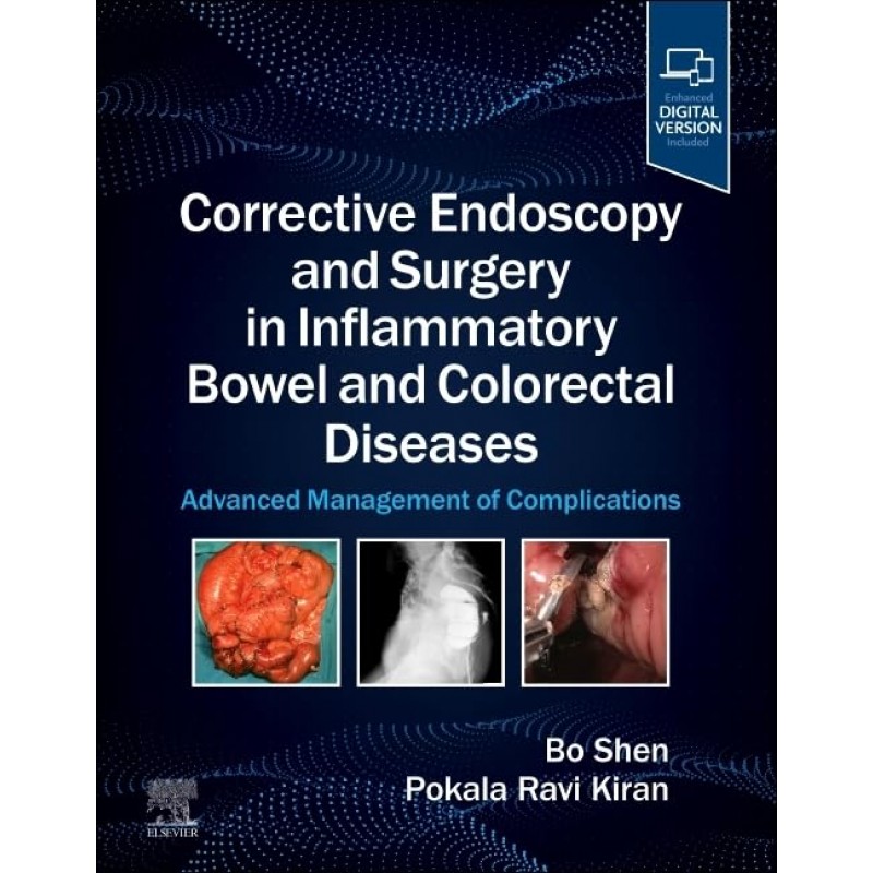 Corrective Endoscopy and Surgery in Inflammatory Bowel and Colorectal Diseases, 1st Edition