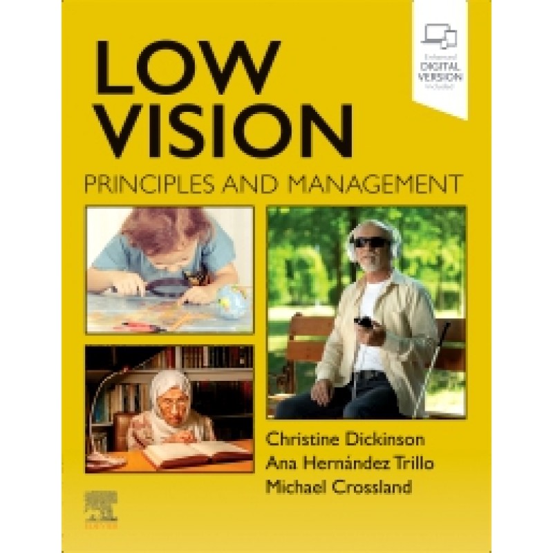 Low Vision: Principles and Management