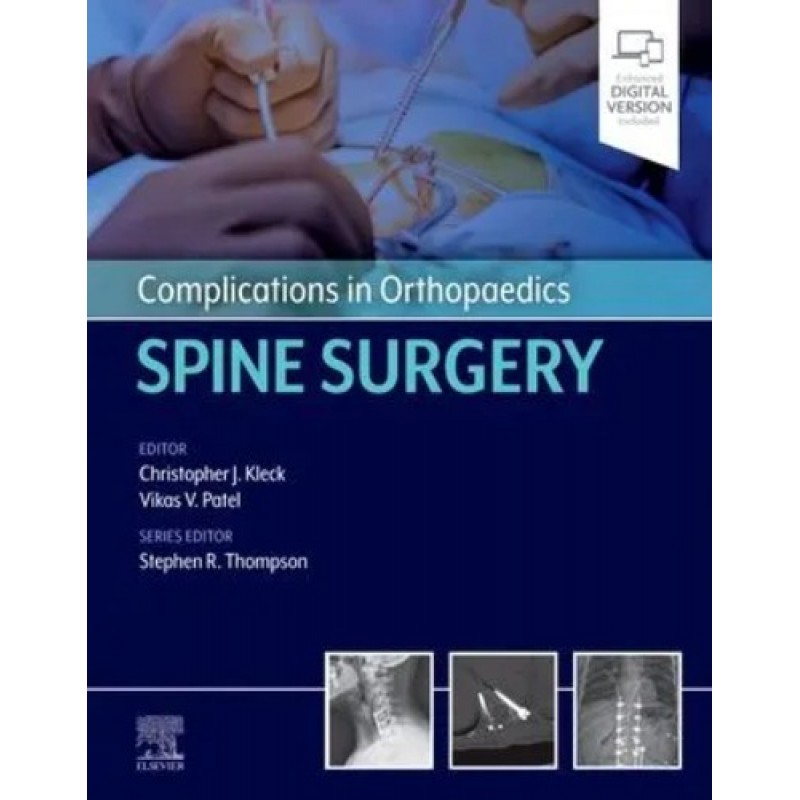 Complications in Orthopaedics: Spine Surgery, 1st Edition