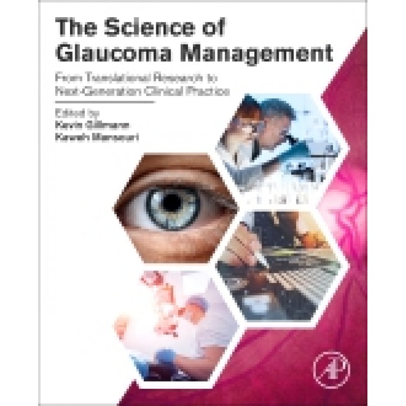 The Science of Glaucoma Management