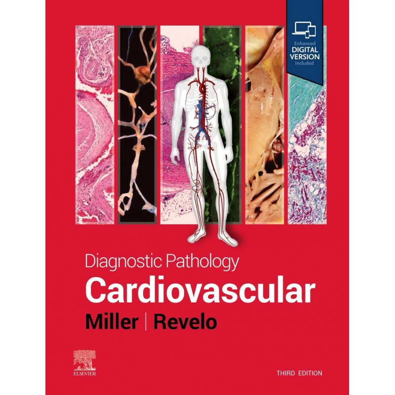 Diagnostic Pathology: Cardiovascular 3rd Edition