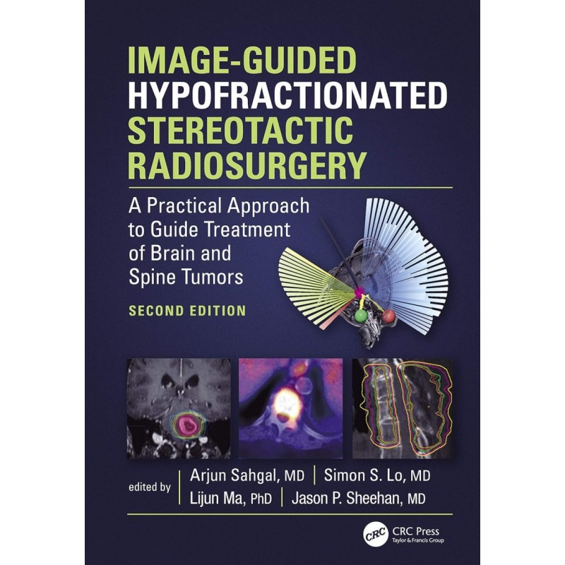 Image-Guided Hypofractionated Stereotactic Radiosurgery. A Practical Approach to Guide Treatment of Brain and Spine Tumors 2nd Edition