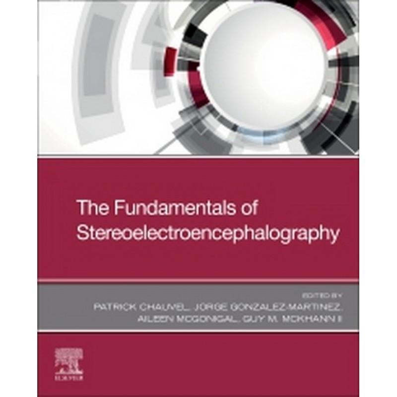 The Fundamentals of Stereoelectroencephalography, 1st Edition