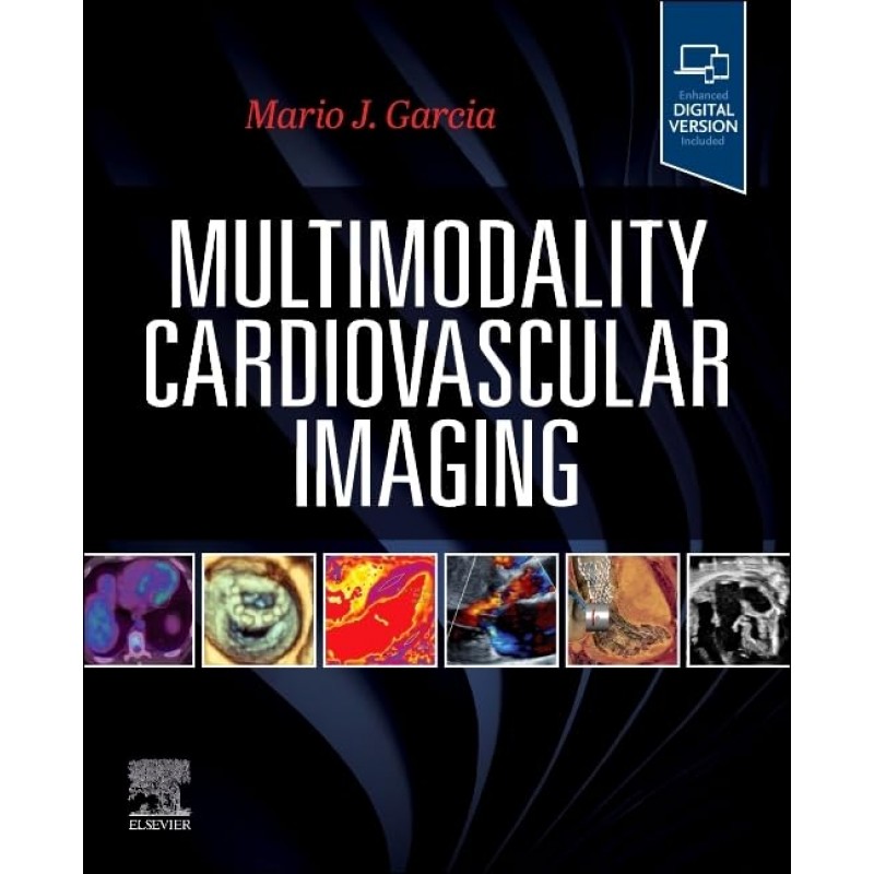 Multimodality Cardiovascular Imaging, 1st Edition