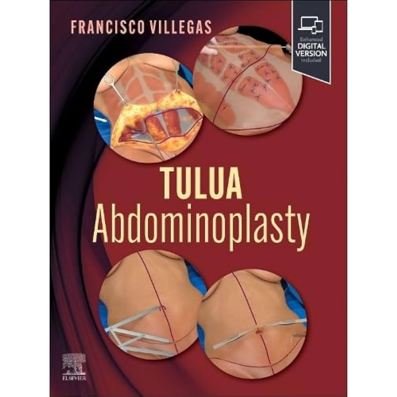 TULUA Abdominoplasty, 1st Edition. Transverse Plication Technique