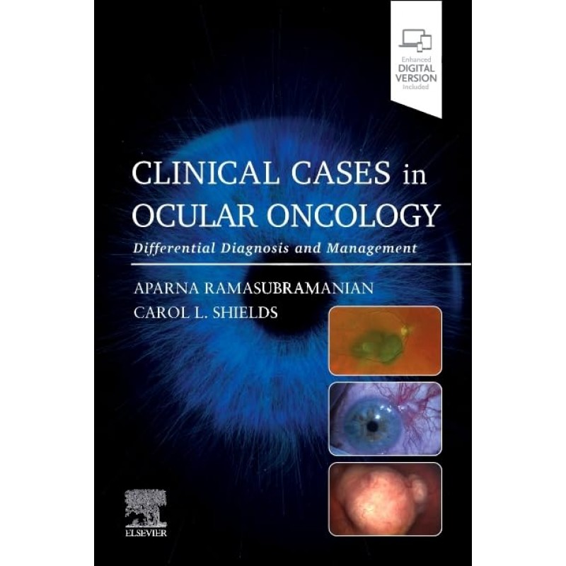 Clinical Cases in Ocular Oncology, 1st Edition. Differential Diagnosis and Management