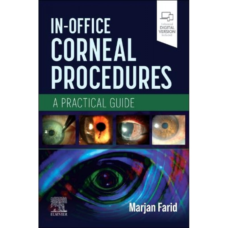 In-Office Corneal Procedures, 1st Edition