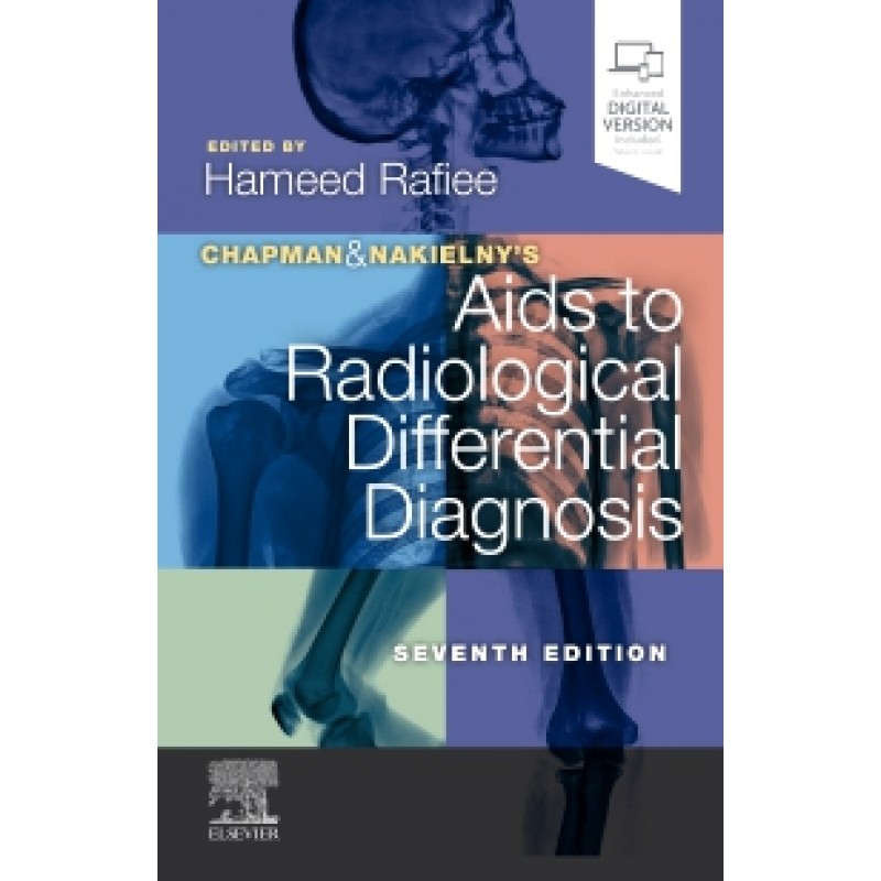 Chapman & Nakielny's Aids to Radiological Differential Diagnosis, 7th Edition