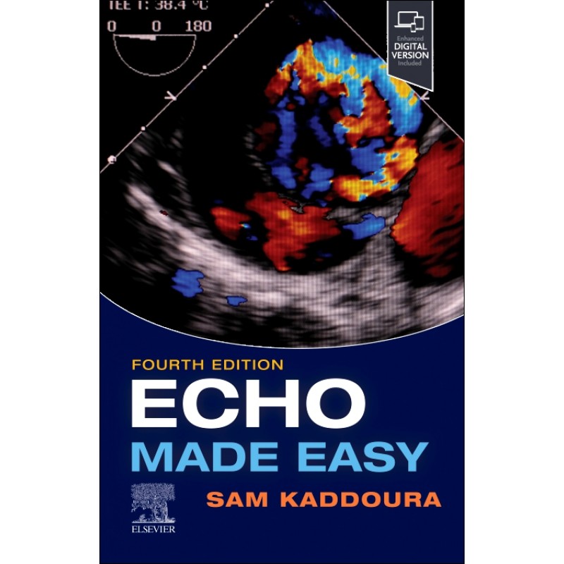 Echo Made Easy, 4th Edition