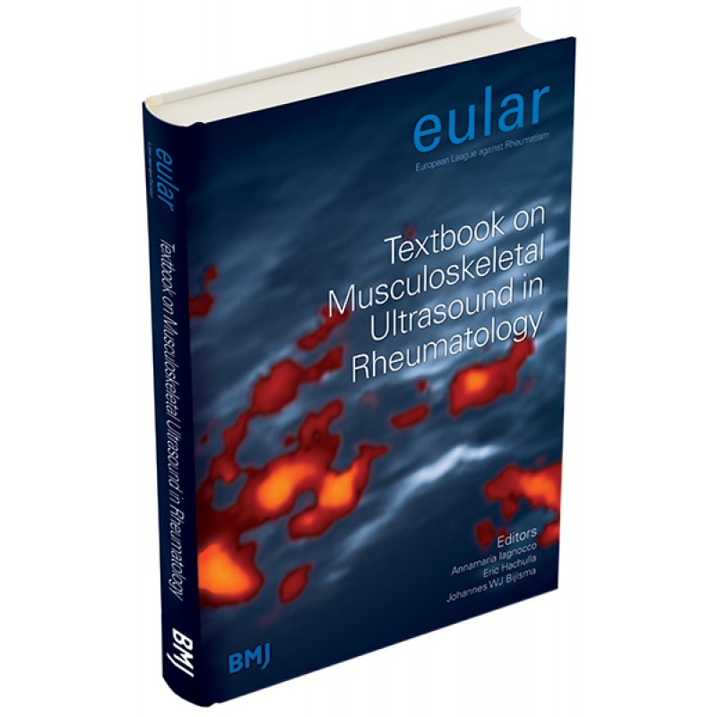 EULAR Textbook on Musculoskeletal Ultrasound in Rheumatology ( ΕΞΑΝΤΛΗΜΕΝΟ ) 