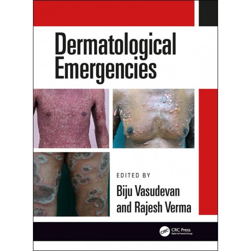 Dermatological Emergencies 