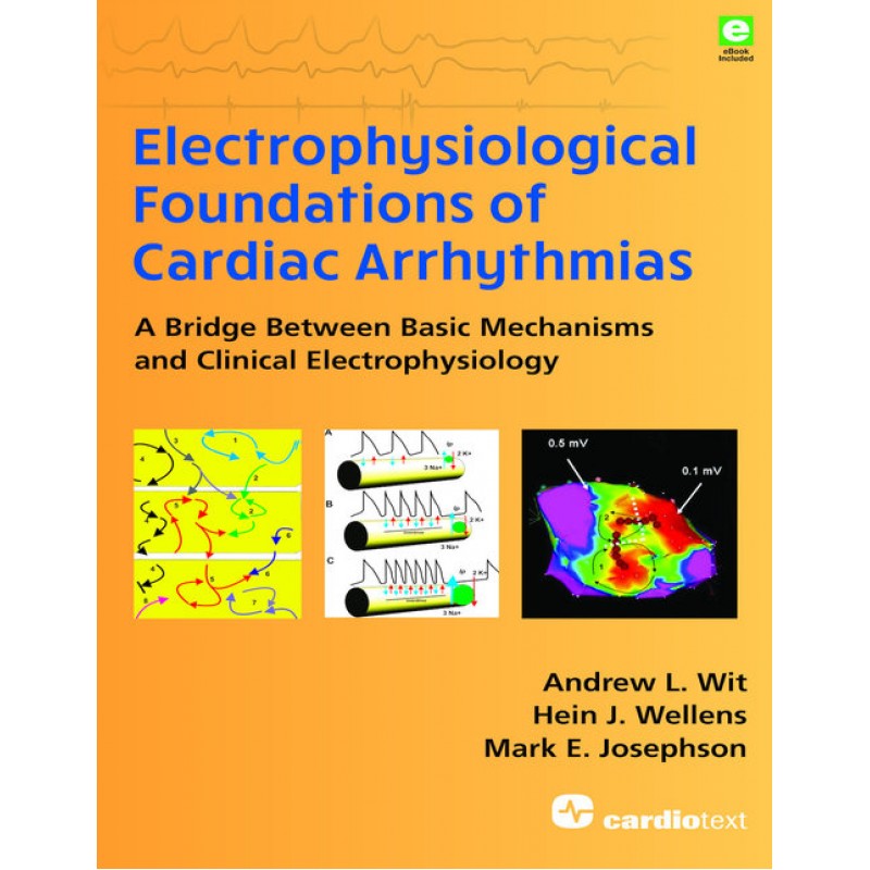 Electrophysiological Foundations of Cardiac Arrhythmias