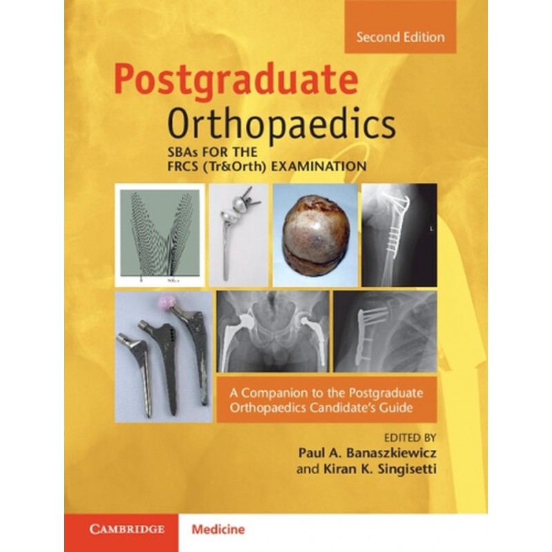 SBAs for the FRCS (Tr&Orth) Examination. A Companion to the Postgraduate Orthopaedics Candidate’s Guide 2nd Edition