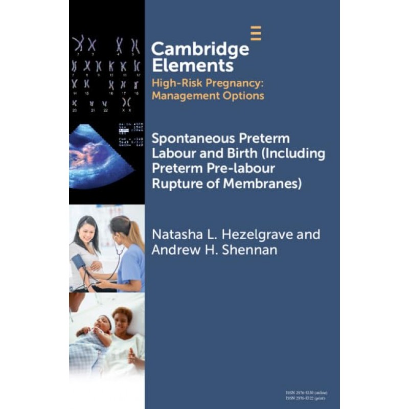 Spontaneous Preterm Labour and Birth (Including Preterm Pre-labour Rupture of Membranes)