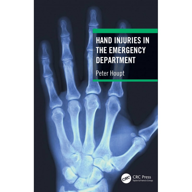 Hand Injuries in the Emergency Department