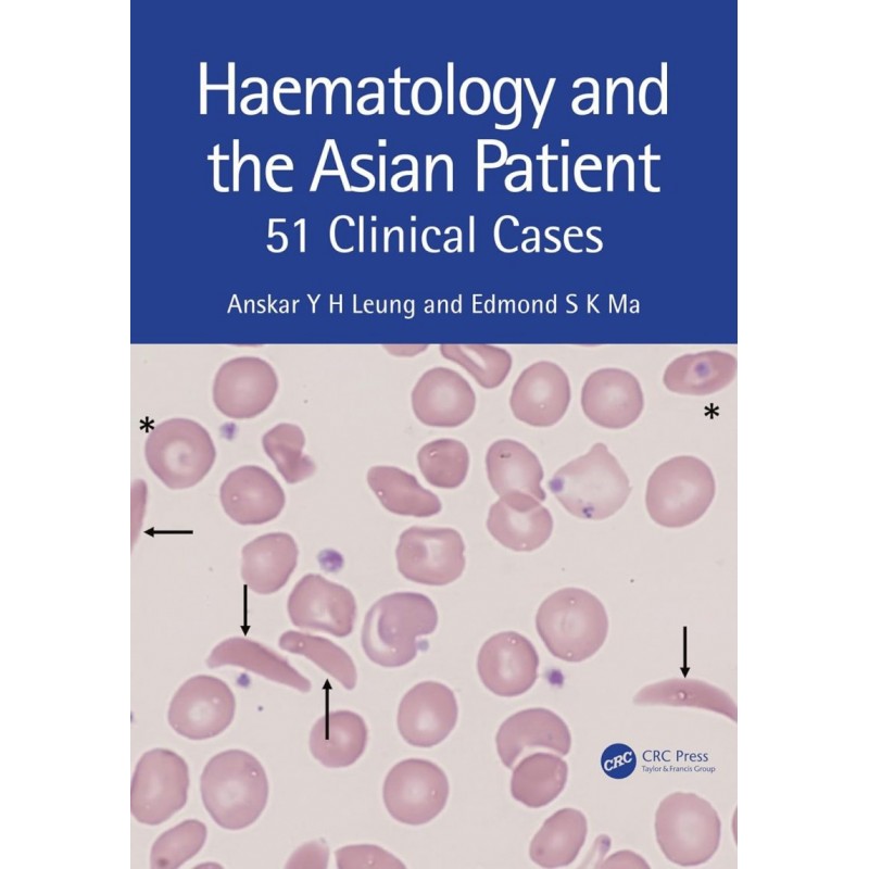 Haematology and the Asian Patient. 51 Clinical Cases