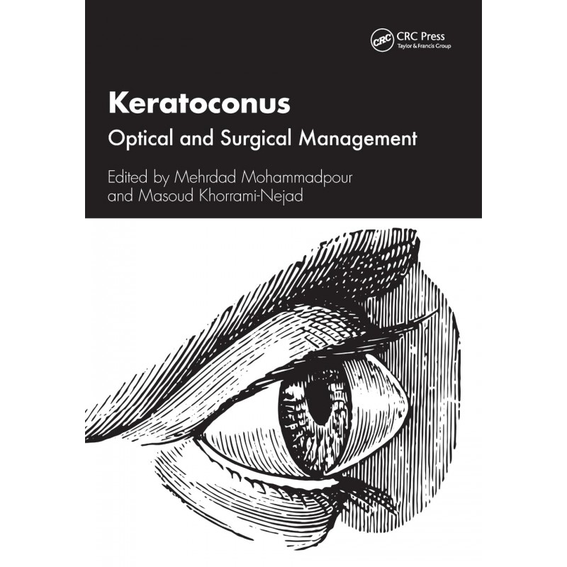 Keratoconus. Optical and Surgical Management